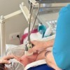 Displasia de cadera: Cribado ecográfico de cadera neonatal 